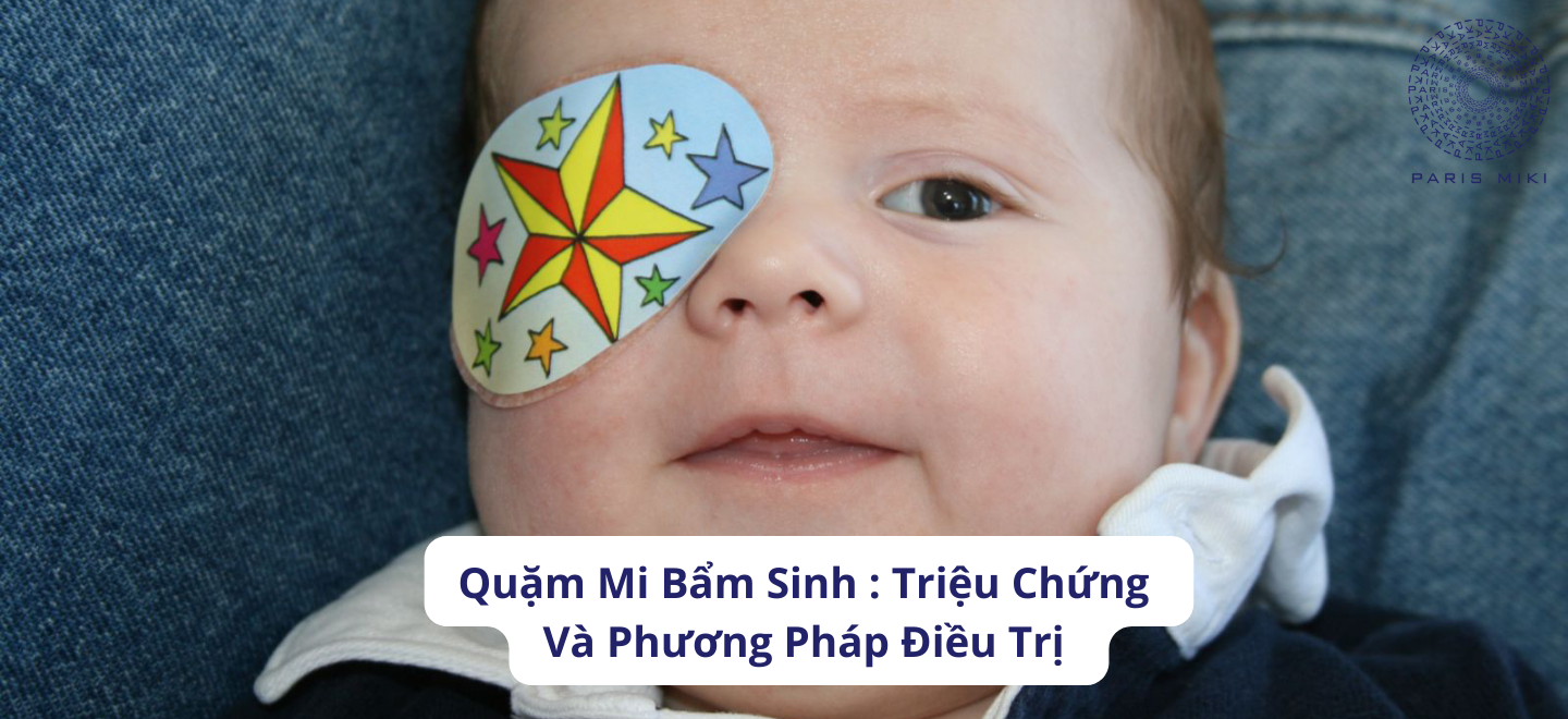 Quặm Mi Bẩm Sinh: Triệu Chứng Và Phương Pháp Điều Trị 