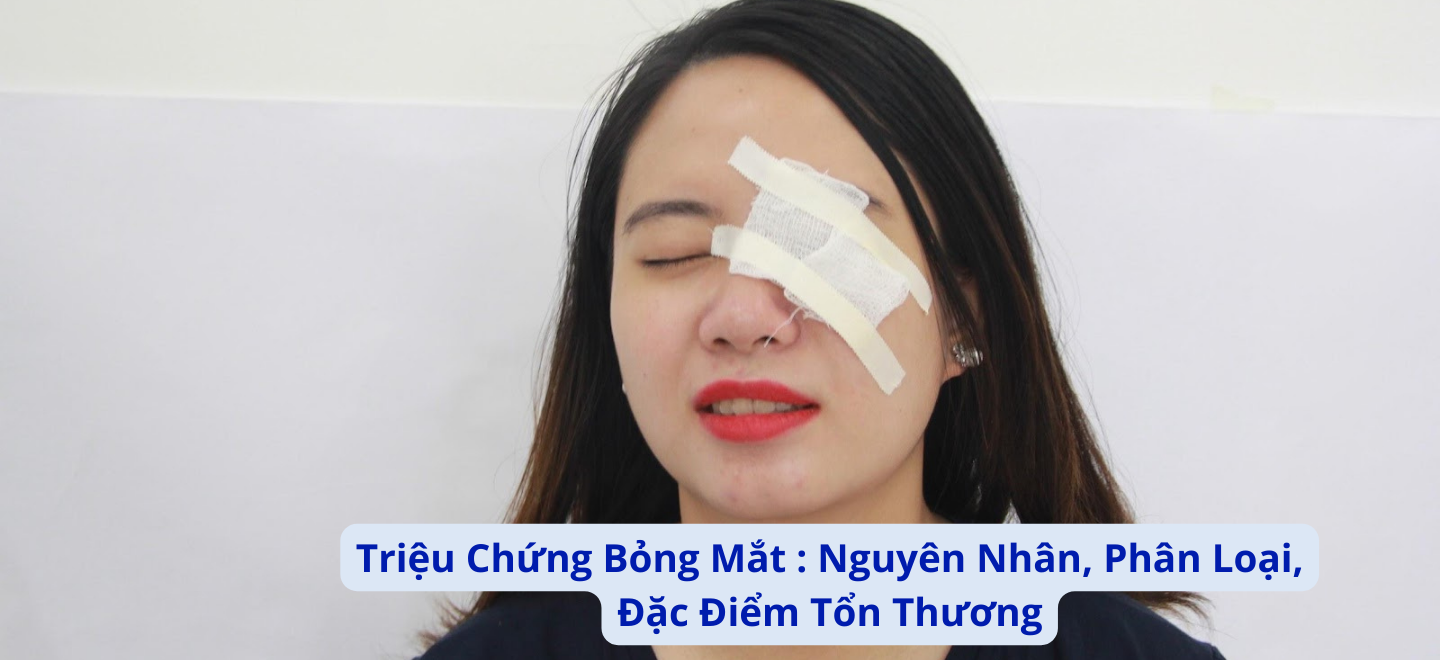 Triệu Chứng Bỏng Mắt : Nguyên Nhân, Phân Loại, Đặc Điểm Tổn Thương
