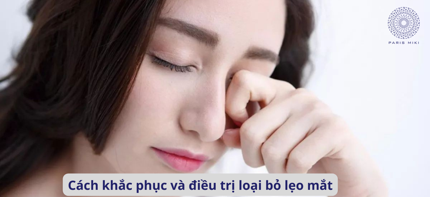 Cách khắc phục và điều trị loại bỏ lẹo mắt