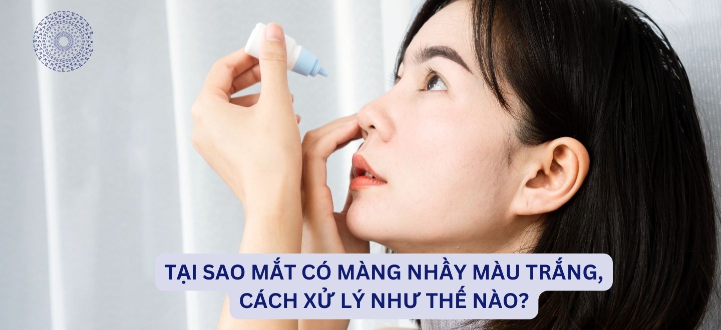 Tại Sao Mắt Có Màng Nhầy Màu Trắng, Cách Xử Lý Như Thế Nào?