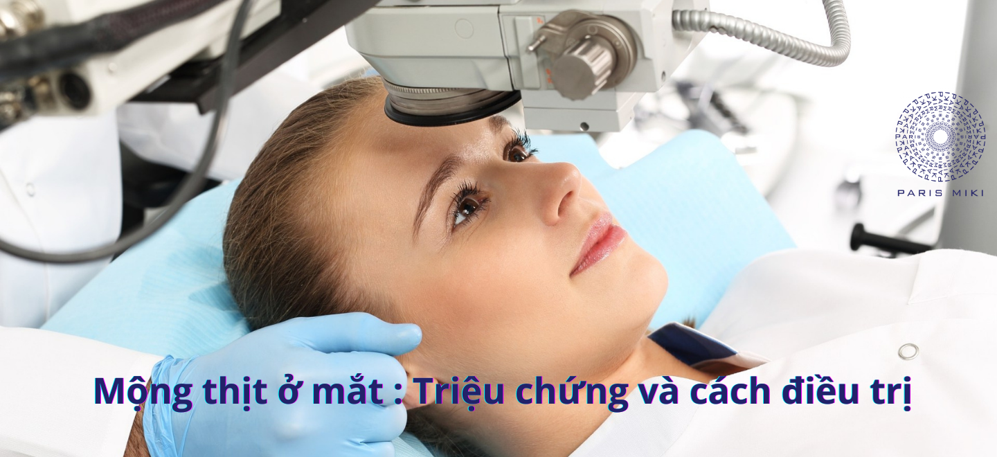 Mộng thịt ở mắt: Triệu chứng và cách điều trị