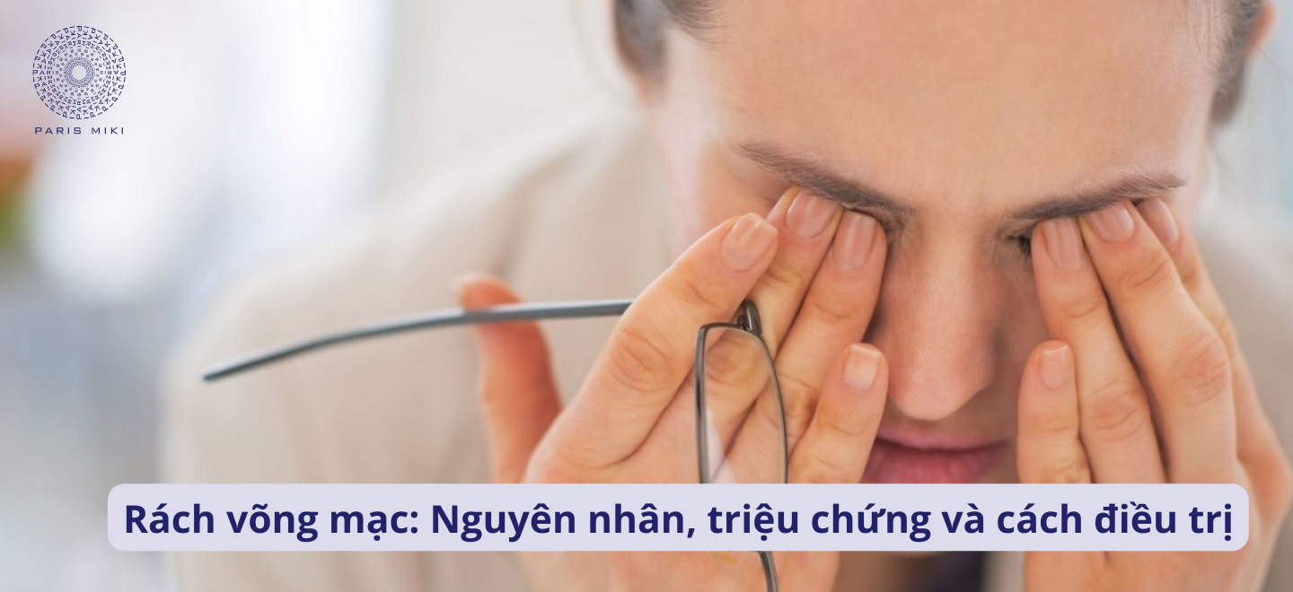 Rách võng mạc: Nguyên nhân, triệu chứng và cách điều trị