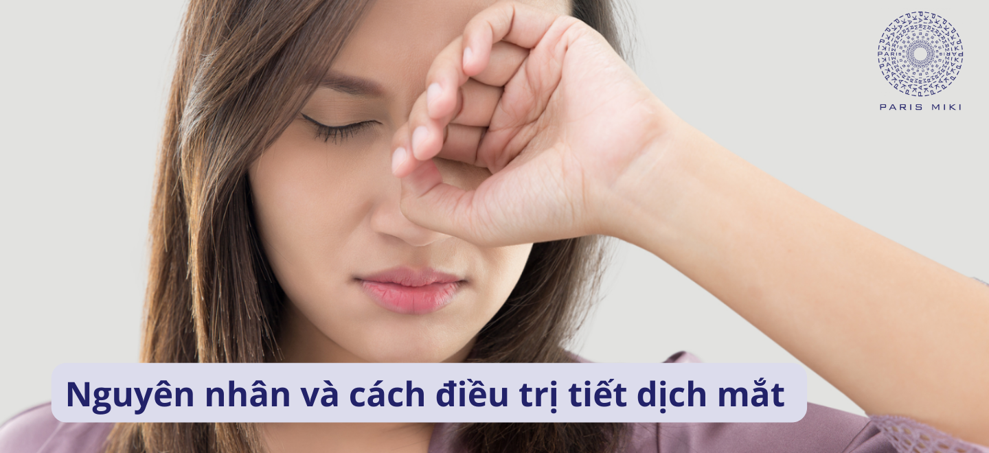 Nguyên nhân và cách điều trị tiết dịch mắt