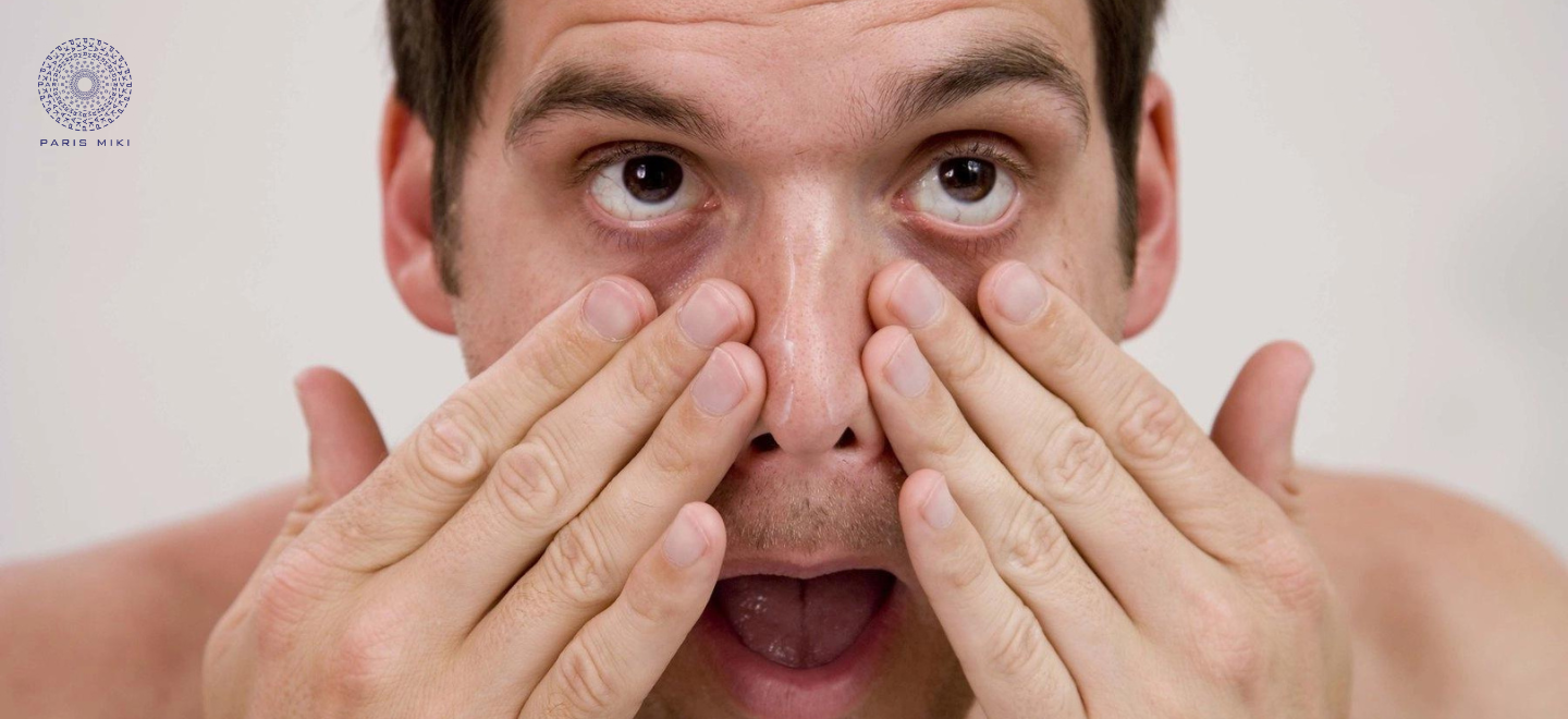 U bì kết giác mạc là gì? Nguyên nhân và cách điều trị